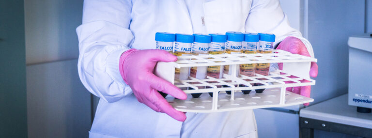 Person holding biobank sample tubes.