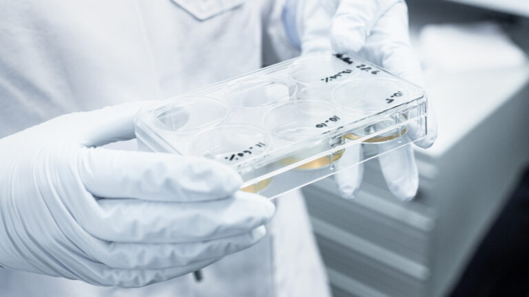A researcher's hands are holding a cell culture substrate.