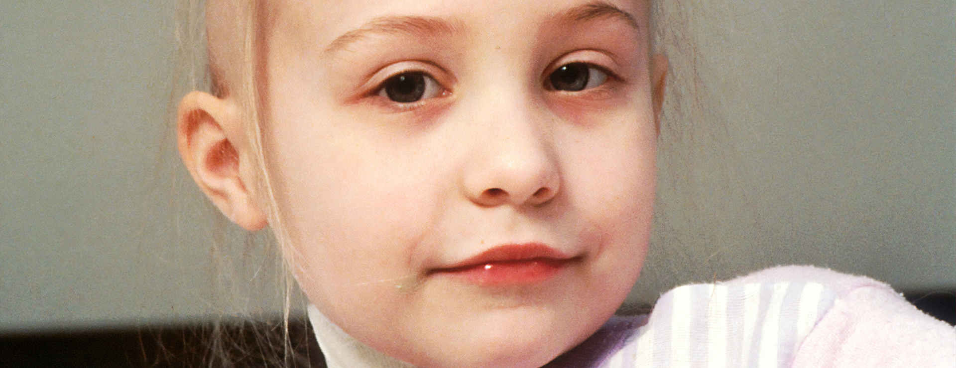 Ett barn med leukemi tittar in i kameran.