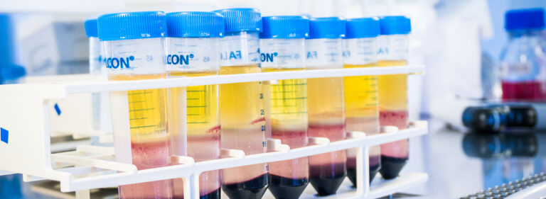 Buffy Coat preparations from the Blood Service biobank in tubes.