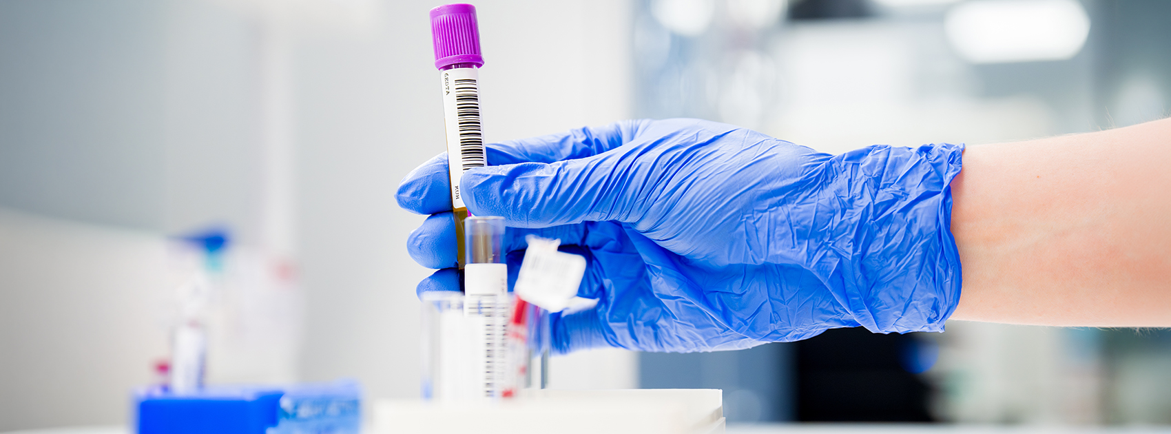 A laboratory worker handling samples.